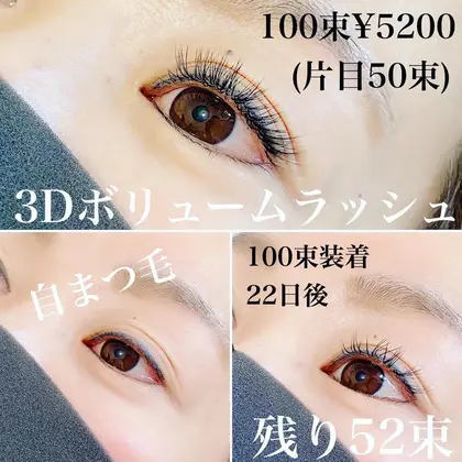 札幌希少アイリッドアップパーマ一重 眼瞼下垂 アイプチで伸びたまぶた 二重幅をはっきりさせたい Eyelash Reward所属 アイラッシュリワード 小山内のマツエクデザイン ミニモ