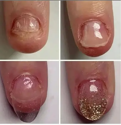 小岩 ネイル所属 小岩 ネイルのメニュー ミニモ