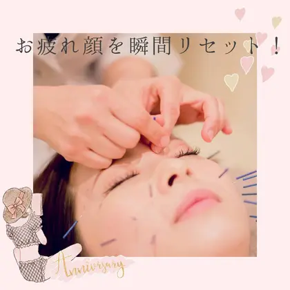 名古屋美容鍼サロンnano Face名古屋駅前店のエステ リラクサロン スタッフ情報 美容鍼 美容矯正saori Minimo ミニモ