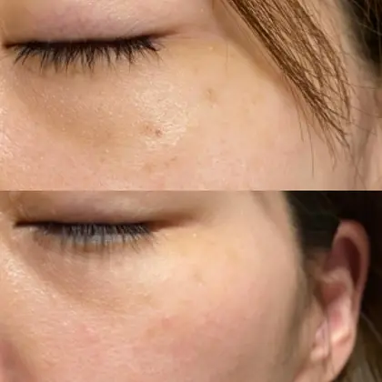 突然の 気づかない コイン 濃い シミ Ryouyou Jp