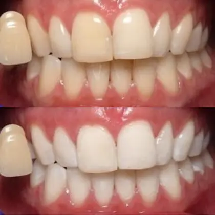 リアン鍼灸接骨院のエステ リラクサロン スタッフ情報 吉本 竜矢 ミニモ