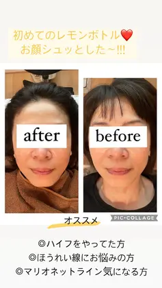 レモンボトル1本・ララピール2回分セット レモンボトル初回