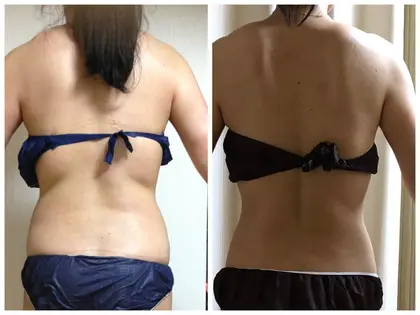 痩身サロンルラシェのエステ リラクサロン エステティシャン セラピスト情報 痩身 インドエステ 筋膜リリース ミニモ