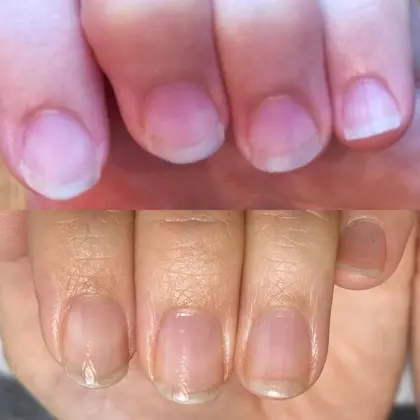 地爪育成 ジェルなしたった３ヶ月で大変身 Nail Salon Citrine所属 一森 李奈のネイルデザイン ミニモ