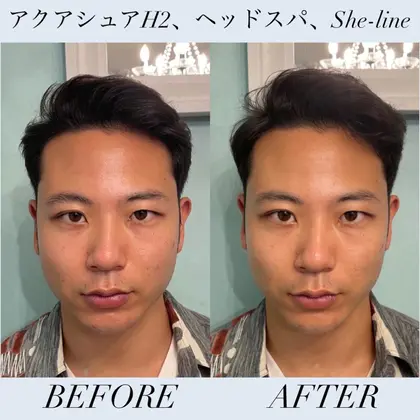 ダブロゴールドのエステマシンshe Line都内でも希少な男性okのサロンです 期間限定 小顔 リフトアップ Lumiere所属 小顔 美肌 ルミエールのエステ リラクカタログ ミニモ