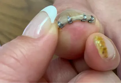 爪先にワイヤーを装着するため 爪 白く伸びた部分 が２ 程必要です オーガニックネイル Le Musee 芦花公園所属 Reiko Hamanoのネイルデザイン ミニモ