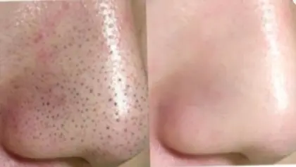 Beauty Amusement所属 坪谷 優子のメニュー Minimo ミニモ