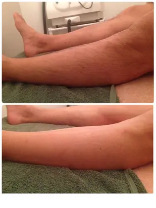 メンズ ひざ下 すね毛 脱毛 Shandeel所属 脱毛 エステサロン Shandeelのエステ リラクカタログ ミニモ