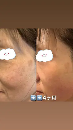 サロン アカデミーgalaギャラ所属 大西 美穂のヘアカタログ ミニモ