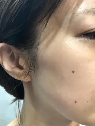 もちもちたまご肌 Chrom Tokyo The Barber所属 シェービング 豊岡 頼夢 のエステ リラクカタログ ミニモ