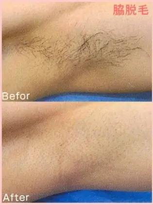 エステサロン Lu Lanaのエステ リラクサロン スタッフ情報 間 千帆 ミニモ