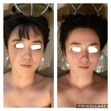 両方の写真向かって右が下がっていることが悩みの 学生様をモデルでやらせていただきました 左側がb プリュボーテ立川所属 瀧澤 愛美のヘアカタログ ミニモ