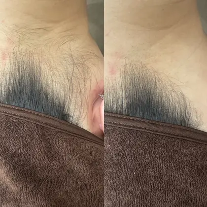 【脱毛・ダイエット・ハーブピーリング】Tug エステサロン　高知駅前店