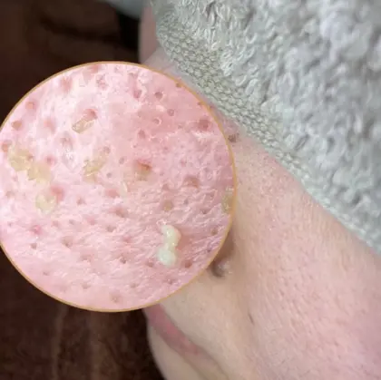 毛穴専門店ルミエールスター