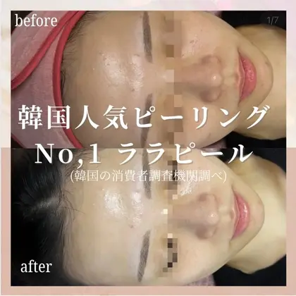 看護師が施術する美容サロン「ナスサロ」