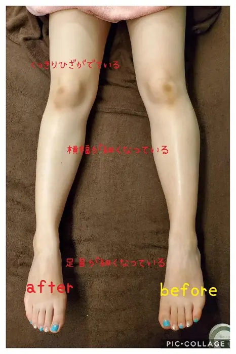 くっきりひざがでて ふくらはぎと足首が細くなっているのがお分かりいただけると思います Seika House所属 Seika Houseのエステ リラクカタログ ミニモ