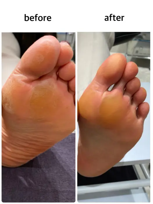 角質ケア 足裏には皮脂腺がないので どうしても乾燥しやすくなります ぜひ綺麗にさせてください Go Today Shaire Salon キラリト銀座店所属 Gtss Rikaのネイルデザイン ミニモ