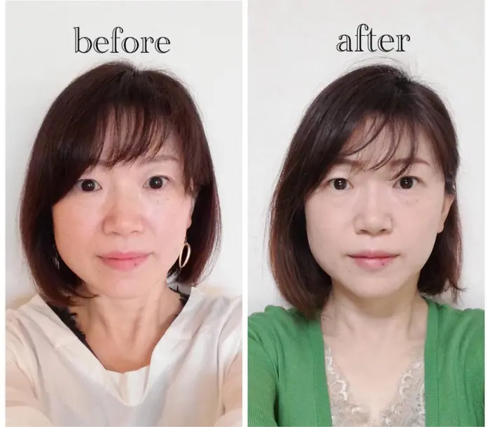 小鼻が小さくなって 鼻筋スッキリ フェイスラインもシェイプされ 各パーツが際立って知的なお顔が出 小顔矯正サロンan所属 小顔矯正専門サロン An アン のエステ リラクカタログ ミニモ