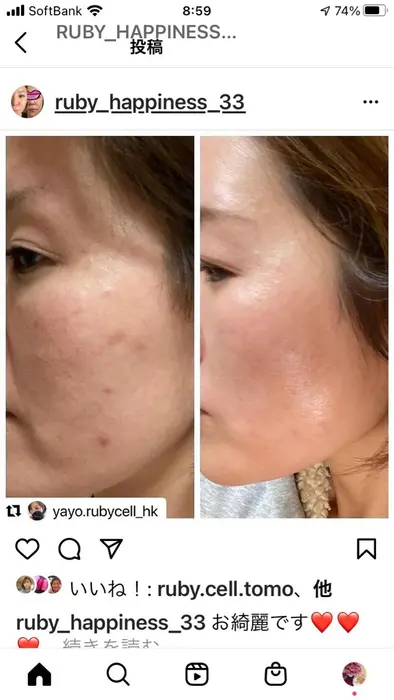 Kirarie所属 片山 理恵のエステ リラクカタログ ミニモ