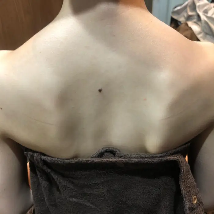 背中シェービング大人気です ご自身でのケアが難しい背中のケア 私たちにお任せください Chrom Tokyo The Barber所属 ツルツル美肌 佐藤鈴音 のエステ リラクカタログ ミニモ