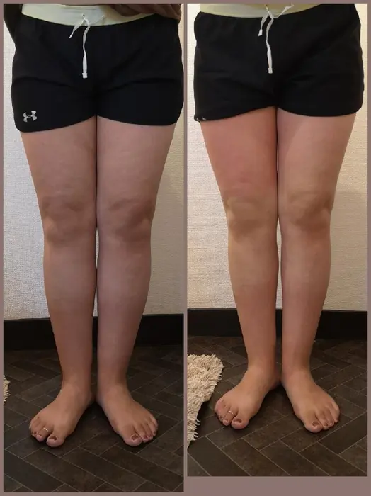 セルライトは放置してはいけません セルライトは身体の器官が正常に働いていないためにダメージを受 Guzel Salon所属 Guzel Safのエステ リラクカタログ ミニモ