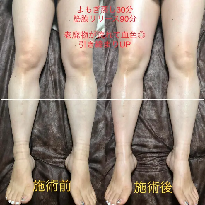 よもぎ蒸しで温めた身体の筋膜を剥がして老廃物 セルライト除去 Carna所属 村岡 未奈のエステ リラクカタログ ミニモ