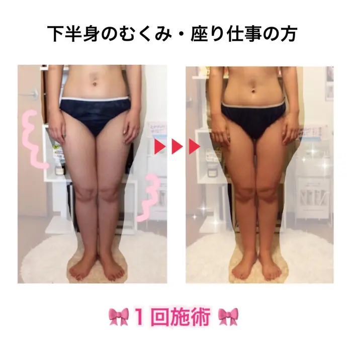 一日中座り仕事で 脚が痛くなって 浮腫むし 太りやすいし 頭痛もあるし 目が疲れて 背中も痛い 健康美サロンfleur所属 ダイエット 素肌ケア Fleurのエステ リラクカタログ ミニモ