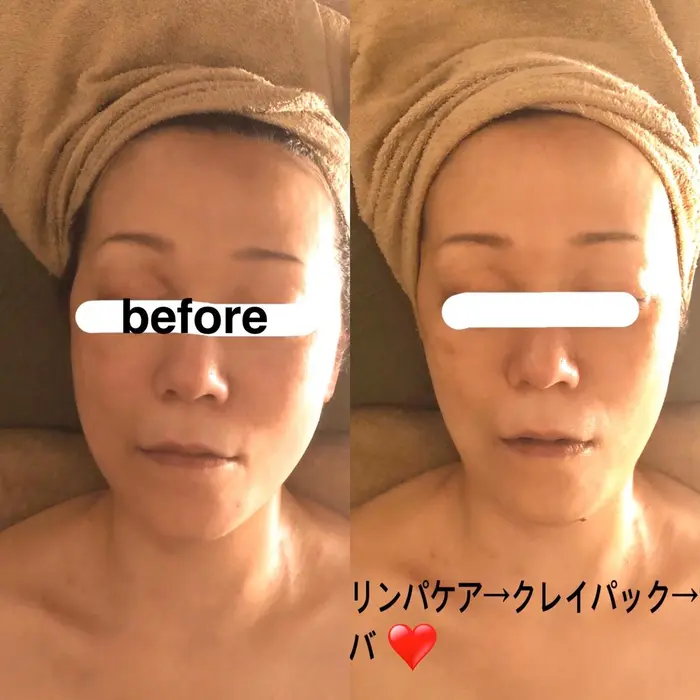 リンパ ツボでハンドケアの後clayパック そして ガルバ エイジングに優れているシリコンパックの Avec Toi アベクトワ クレイ リンパ デトックスサロン Avec Toi アベクトワ所属 大西 知世のエステ リラクカタログ ミニモ