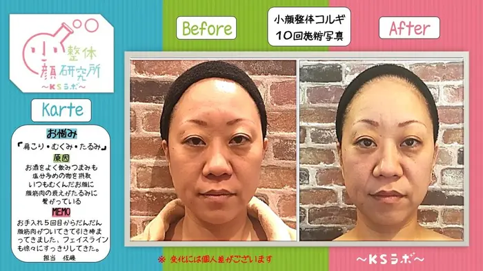 比較写真 小顔整体研究所 Ksラボ 岐阜店所属 小野 えりかのエステ リラクカタログ ミニモ 比較写真 小顔整体研究所 Ksラボ 岐阜店所属 小野 えりかのエステ リラクカタログ ミニモ