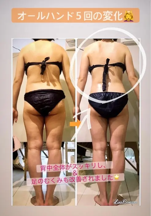 本日のbefore After オールハンド施術５回 背中の厚み お腹の横幅 太 Meguru所属 痩身専門エステ 結果出し丹野のエステ リラクカタログ ミニモ