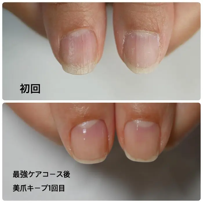 30代web関係 最強のネイルケアコース10回終了後 メンテナンスケア1回目 施術時間約60分 つぼみネイル所属 大阪市ネイルサロン つぼみネイル のネイルデザイン ミニモ