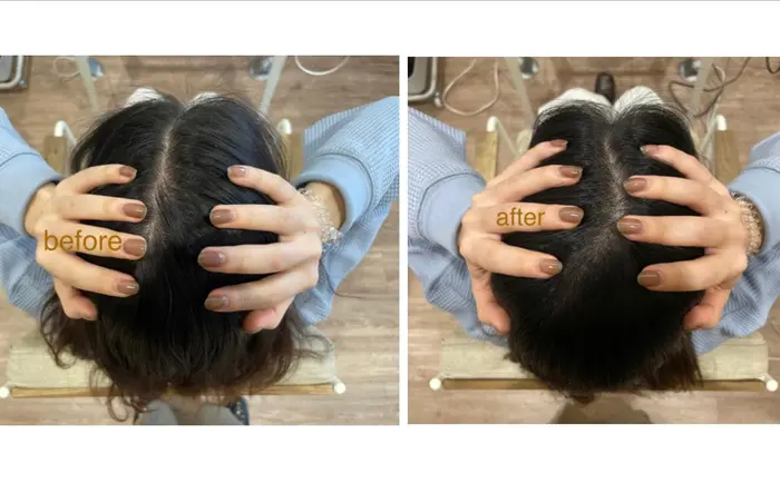 頭皮をケアできるヘッドスパ 60分コースで 頭がスッキリしました 頭皮にかゆみ フケ 匂い 乾 Morio From London 大宮店所属 唐澤 千尋のヘアカタログ ミニモ