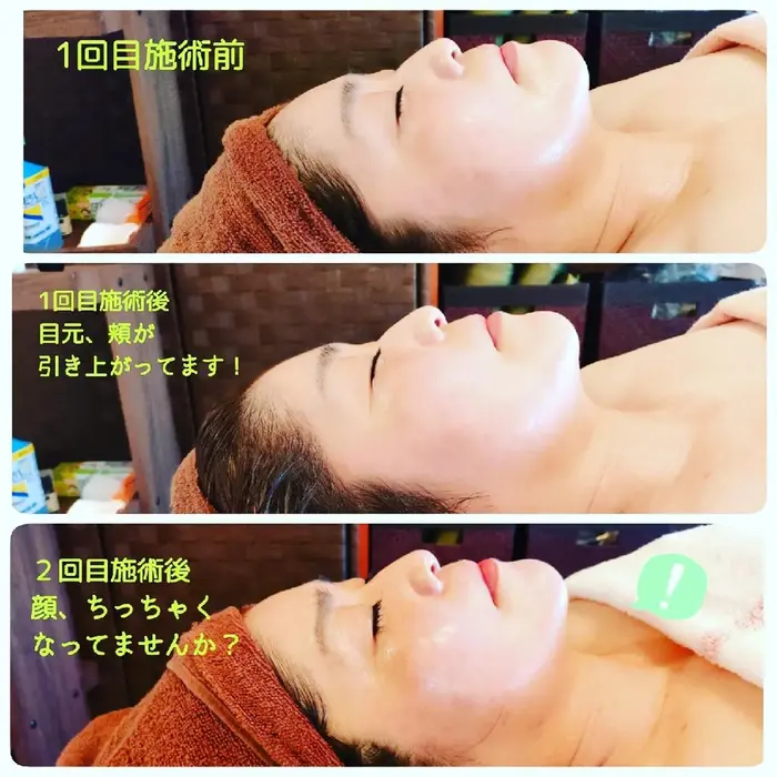 美点かっさフェイシャル施術のビフォーアフターです 回を重ねる毎にお顔が引き上がってシャープになりま ココロとカラダホッコリ処 白蓮所属 山下 佐枝子のエステ リラクカタログ ミニモ