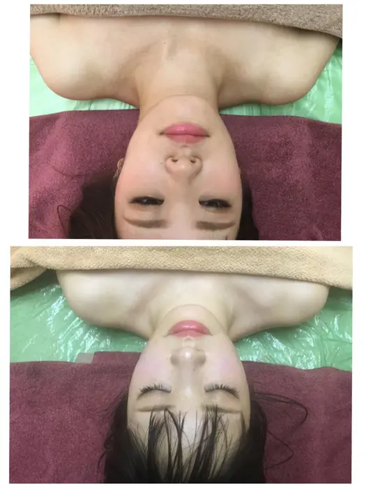 ラジオ波小顔で続けてすれば 美白効果も٩ ۶ アロマリエ所属 ラジオ波専門サロン アロマリエ のエステ リラクカタログ ミニモ