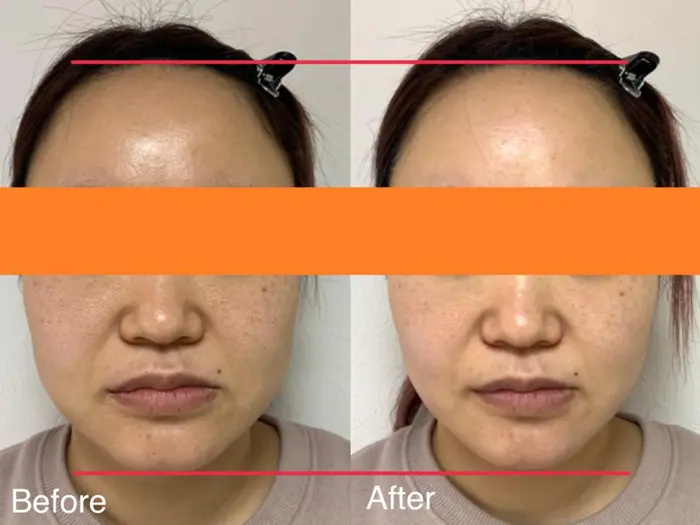 Ibeセルフエステ 即効性のある特殊超音波マシンでお肌の土台からしっかりとケア 小顔 美肌 Behaing E8cube高崎店所属 Behaing E8cube高崎店のヘアカタログ ミニモ