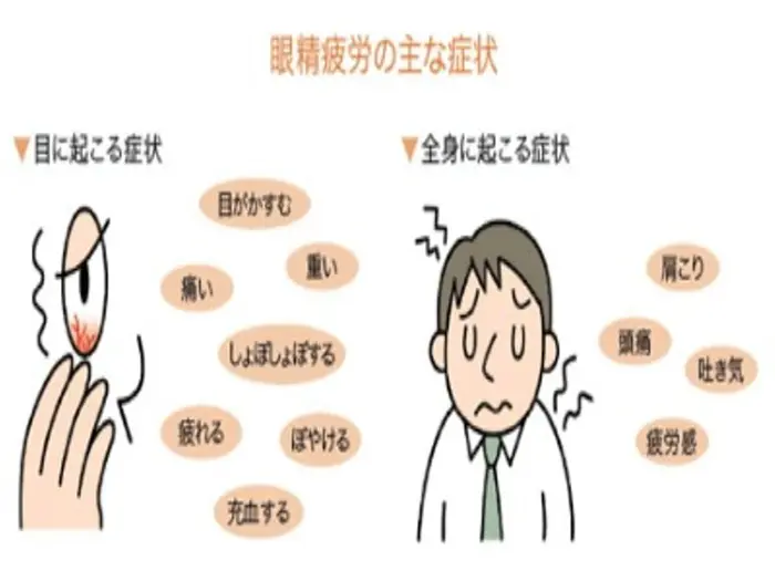 頭痛 肩コリ イライラ そのカラダの疲れ 原因は 眼精疲労 かも 癒しい整体院所属 伊藤 整体院セラピスト のヘアカタログ ミニモ