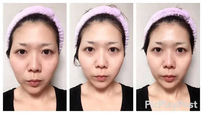 フェイシャルガルバニック電流 やまだ鍼灸接骨院 やまだしんきゅうせっこついん 所属 山田 晃のエステ リラクカタログ ミニモ