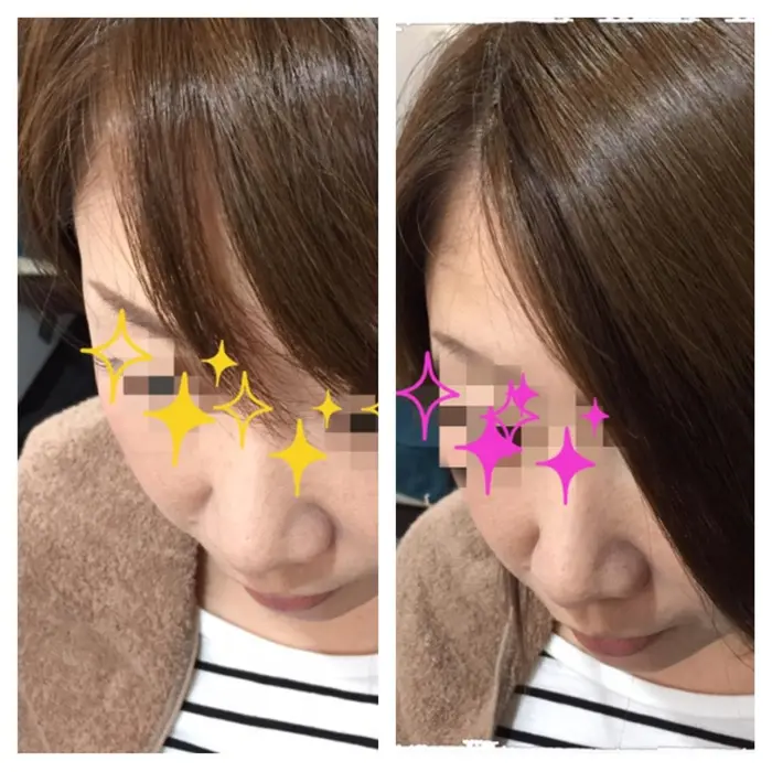 前髪エクステで邪魔な前髪をスッキリ Link Extensions所属 M Mamiのマツエクデザイン ミニモ