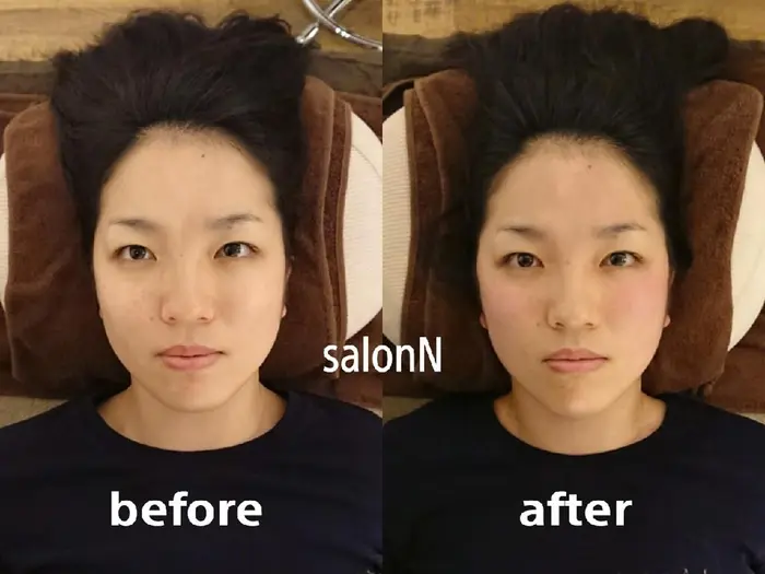 小顔矯正 Total Body Salon N目黒所属 高橋 正純のヘアカタログ ミニモ