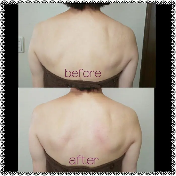 背中トリートメント 凝りもすっきり 背中ニキビの方もツルツルになりますよ Cocohana 所属 小西 あかねのエステ リラクカタログ ミニモ