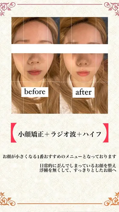 ひとつ前の投稿の続きです 夏向けキャンペーン です 6 7 7 31までです 美容 整体サロン Berry S所属 坂元 果林のエステ リラクカタログ ミニモ