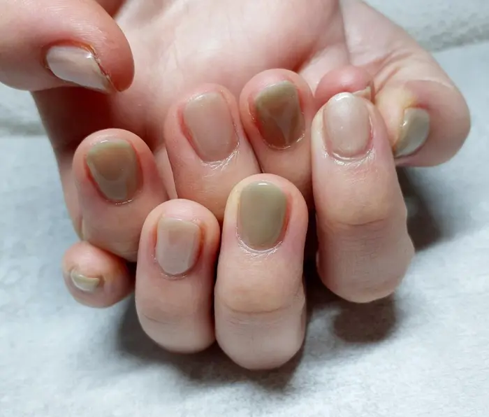 2色カラーネイル 交互にカラー シアー系との相性はバッチリです Pisca Pisca所属 神戸市兵庫区 格安ネイルサロンのネイル デザイン ミニモ 2色カラーネイル 交互にカラー シアー系との相性はバッチリです Pisca Pisca所属 神戸市兵庫区 格安ネイルサロンのネイル デザイン ミニモ