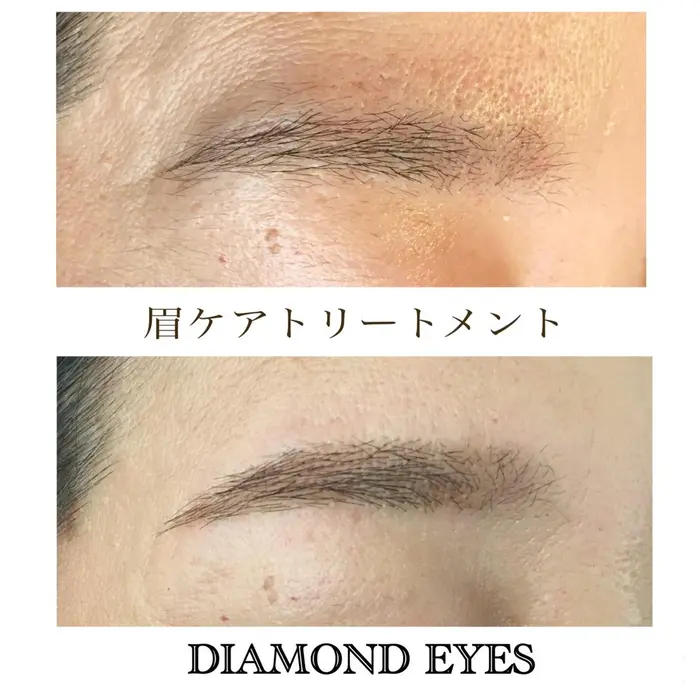 周りのいらない毛や産毛を毛根から脱毛することによって お手入れやメイクがとてもラクになります お肌 ダイヤモンドアイズ 代沢店所属 店長 仙田山 かすみのマツエクデザイン ミニモ