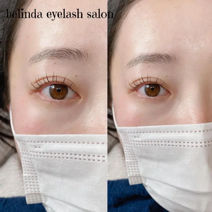 フェイスワックスとは お顔全体の要らない毛をワックスで取ります おでこ 鼻下 頬 もみあげ 小 Belinda Eyelash Salon所属 Belinda 近藤のアイブロウ 眉毛カタログ ミニモ フェイスワックスとは お顔全体の要らない毛をワックスで取ります おでこ 鼻下 頬 もみあげ 小 Belinda Eyelash Salon所属 Belinda 近藤のアイブロウ 眉毛カタログ ミニモ