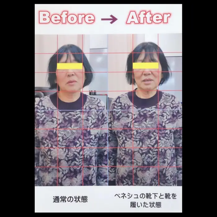 足裏のアーチを整えるだけでこれだけの変化があります フットケア アーチ所属 佐藤 香菜子 のエステ リラクカタログ ミニモ
