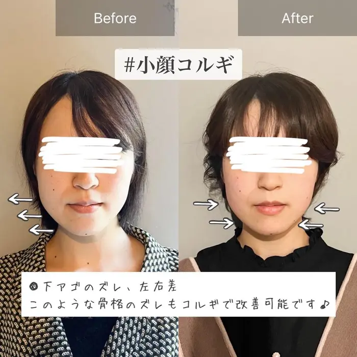 顔 コルギ とは – 小顔コルギ やめたほうがいい | 韓国の小顔エステ・骨気(コルギ)おすすめ店 – LKFVNM