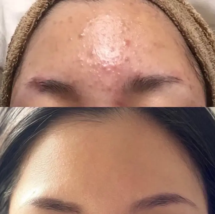 ”日本功労学会”というお医者さんの会でも認められた肌再生を目的とし?...