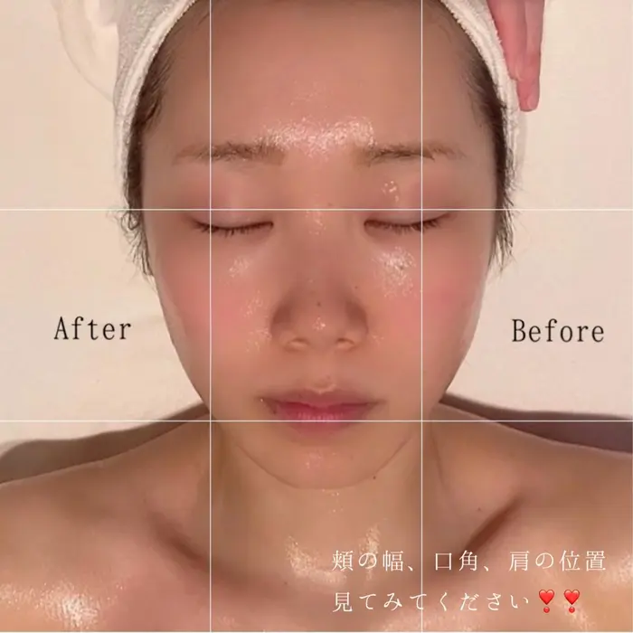 超音波美顔器 Sonic Primoluce所属 小原 杏実のエステ リラクカタログ ミニモ