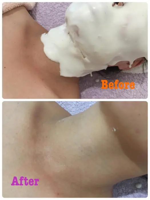 驚きの効果 日焼けは怖いですs ゚d゚ Y そのままにしないでください ホワイトニングパック メナード会瀬町所属 オーナー 佐藤志穂のエステ リラクカタログ ミニモ