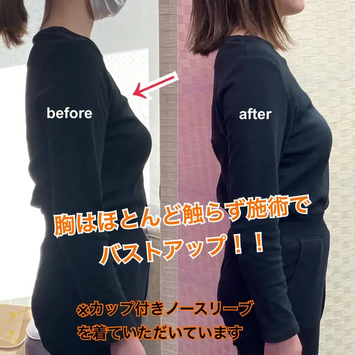 一回の施術前後 女性はもちろん男性にもよく喜んでいただく胸の形の変化 下半身メイン 背中肩の調整後の Any Body Tokyo所属 動作から変える 美容整体 高橋悦子のエステ リラクカタログ ミニモ